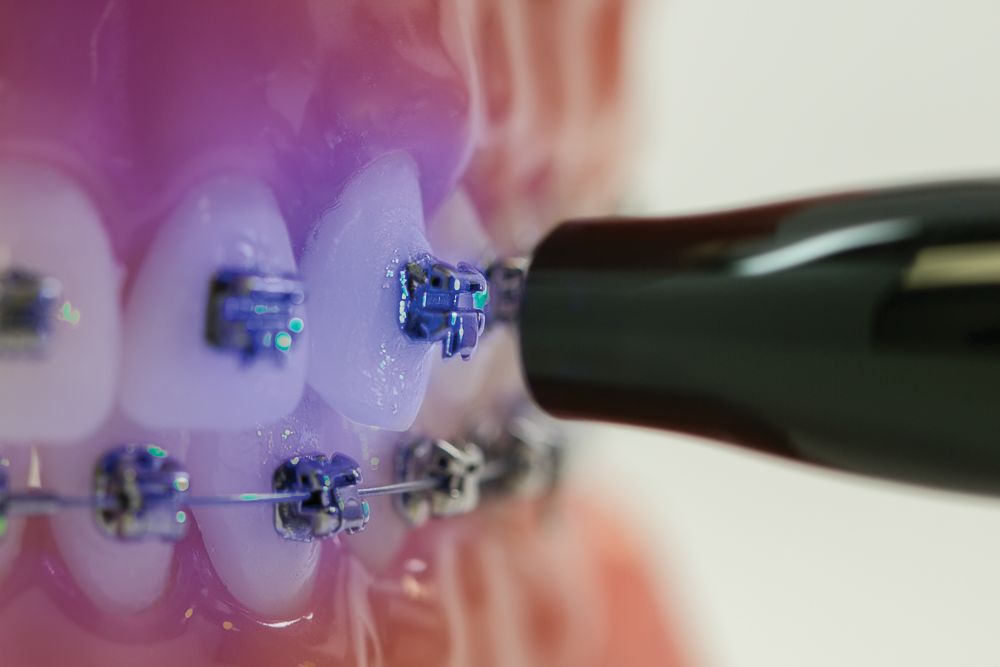 034 Demi_QBracket